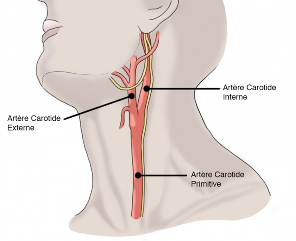 Сонная артерия расположение. Расположение сонной артерии на шее у человека. Общая Сонная артерия располагается. Сонная артерия где находится как нащупать