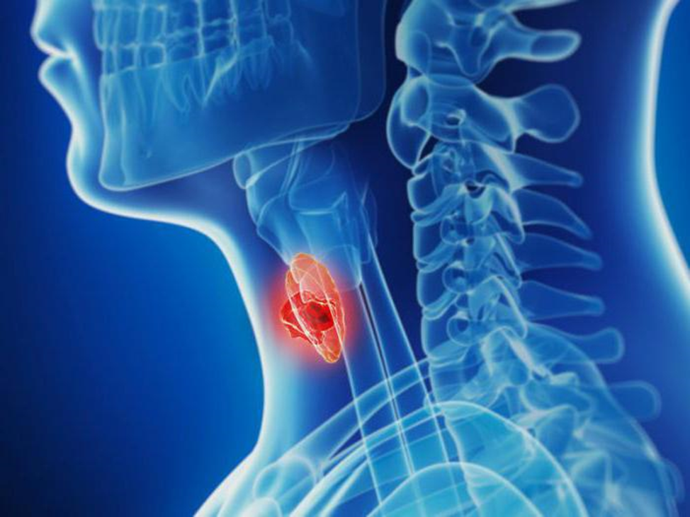 Тиреоидит острый: признаки воспаления щитовидной железы