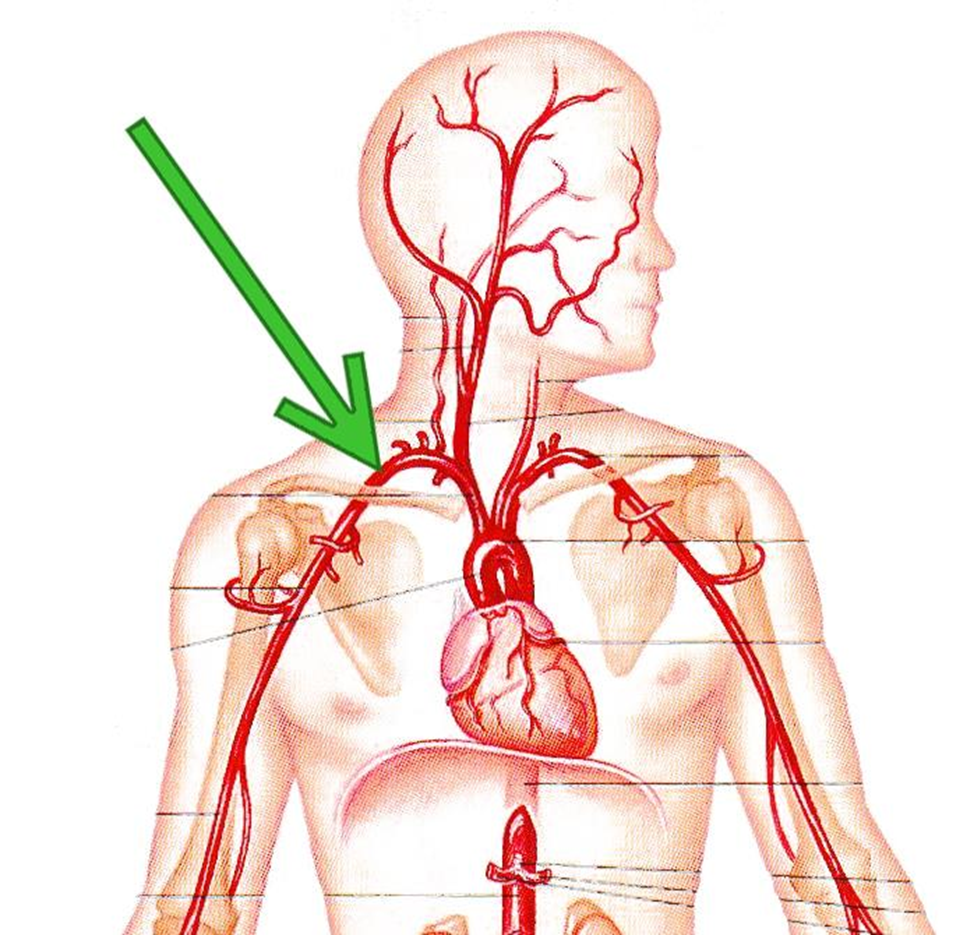 Почему пульсирует вена. Правая подключичная артерия анатомия. Подключичная артерия и ее ветви. Сонная и подключичная артерия. Левая подключичная артерия анатомия.